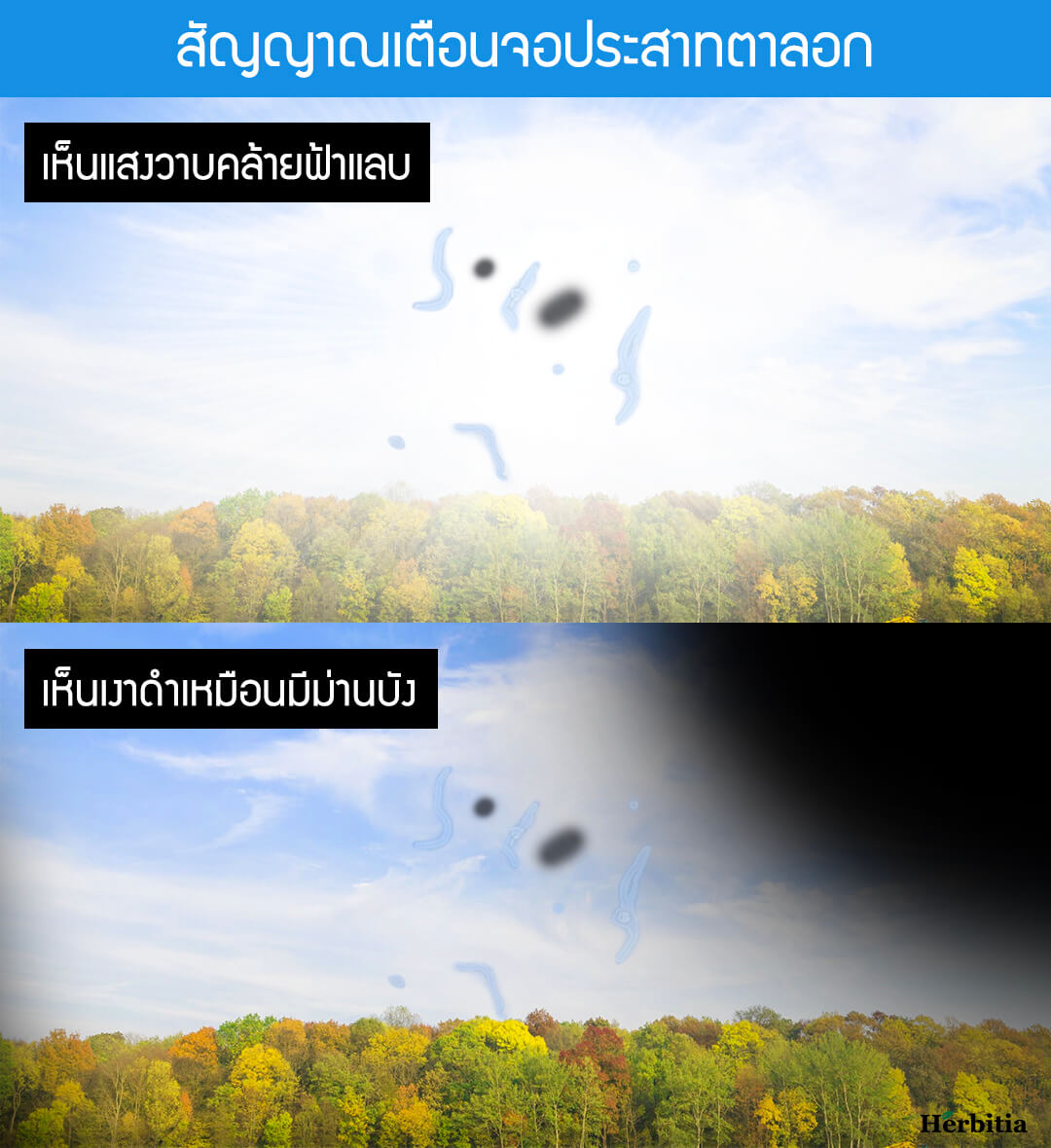 รีวิว จบปัญหาวุ้นในตาเสื่อม จอประสาทตาลอก ด้วย “เฮอร์บิเทีย ลูทีน พลัส ...